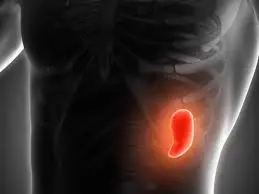 Splenomegali (Dalak Büyümesi): Belirtileri, Nedenleri ve Tedavisi